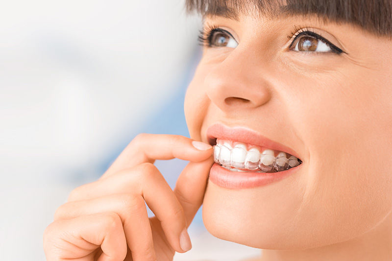 Invisalign in Lumberton