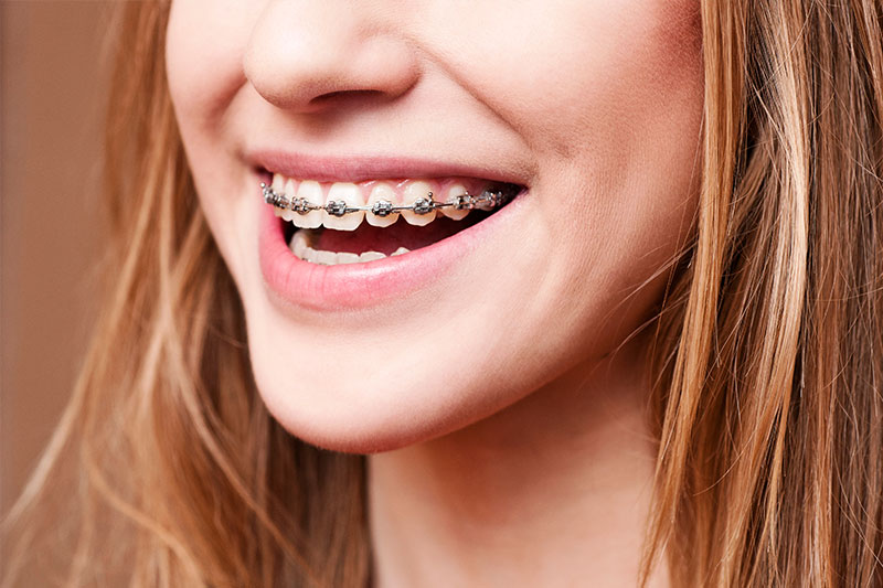 Orthodontics in Lumberton